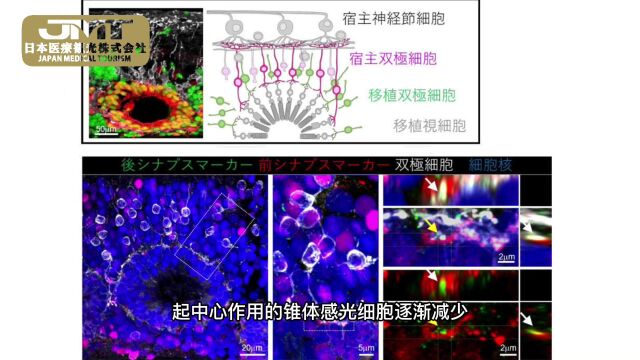 日本干细胞——ES细胞制作接近理想的视网膜组织