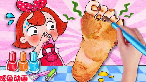 趣味定格动画：小美被海胆刺到脚，小龙人帮她治疗受伤的小脚！