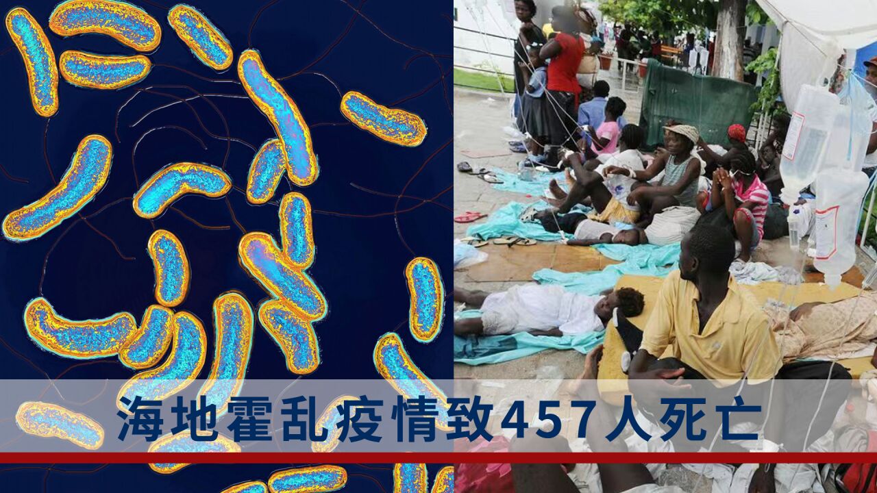海地霍乱疫情:感染最多的年龄段是1岁至4岁