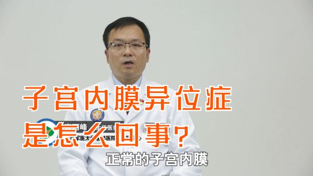 主任医师:子宫内膜异位症是怎么回事?