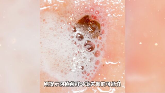 过氧化氢阳性怎么治疗呢?