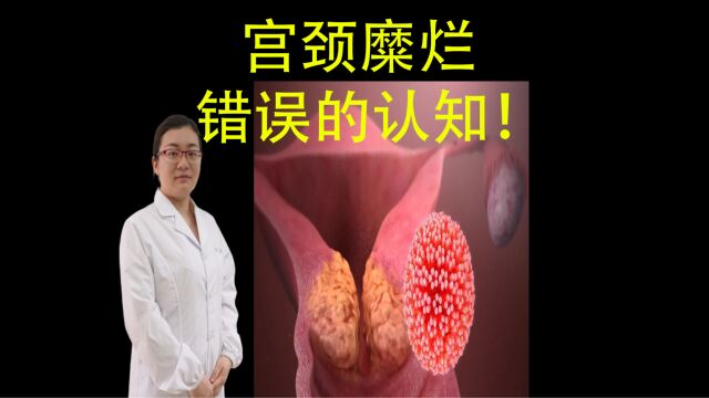 宫颈糜烂,女性的错误认知!