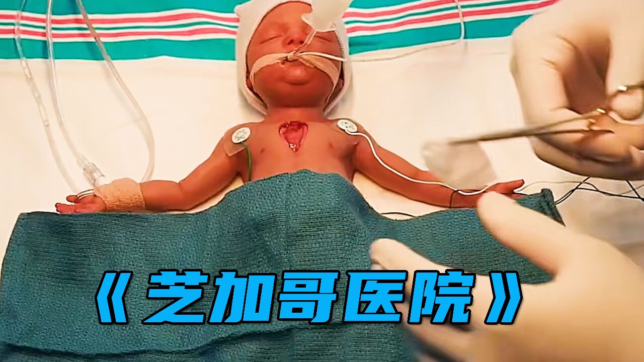 婴儿的心脏长在身体外面,该如何装回去,却把医生给难住了!
