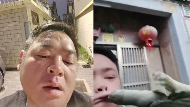 男子炫耀甲鱼时被咬嘴巴,用力向外扯嘴唇表情扭曲:和你“吻鳖”