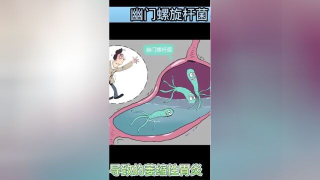 齐市齐鹤胃肠病医院—齐市正规的胃肠病医院