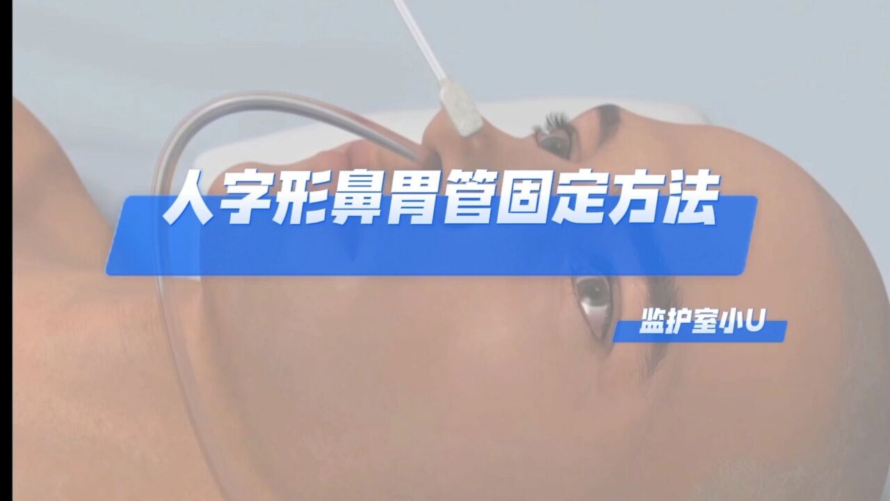 人字形鼻胃管固定方法_高清1080P在线观看平台_腾讯视频