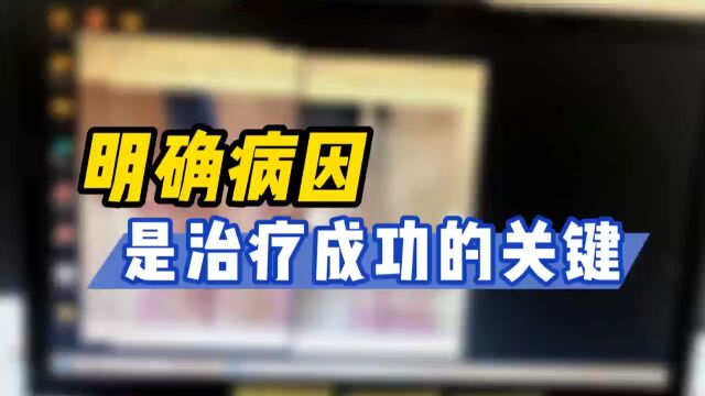 西安白癜风专业医院西安远大白癜风医院明确病因是治疗成功的关键