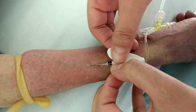 留置针穿刺手法_腾讯视频