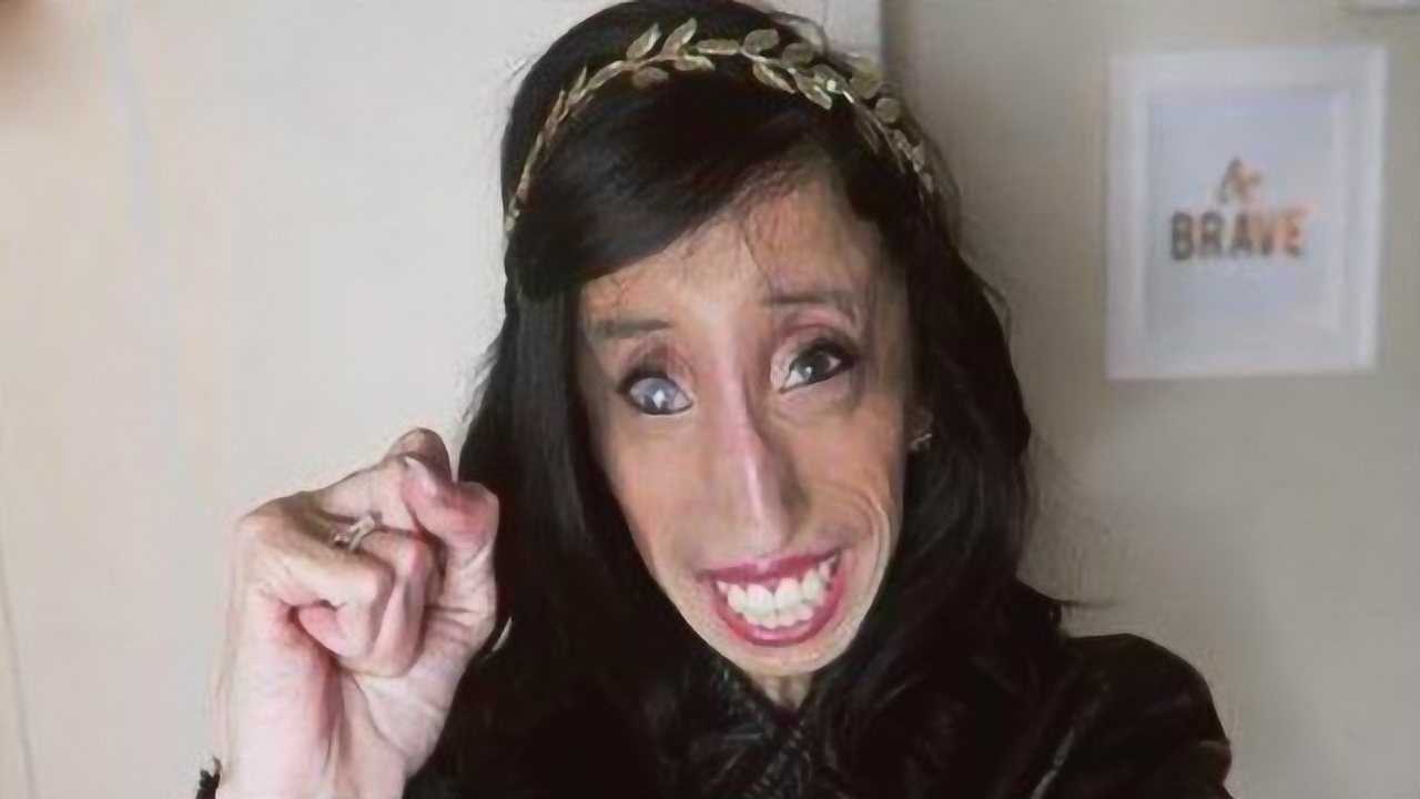 世界上最丑的女人，被2亿网友恶毒攻击，却成为千万富翁！_腾讯视频