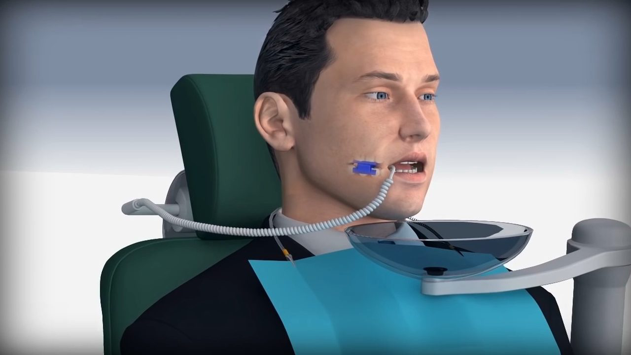 用智能机器人来治疗牙齿疼痛放在口腔里如同机械加工