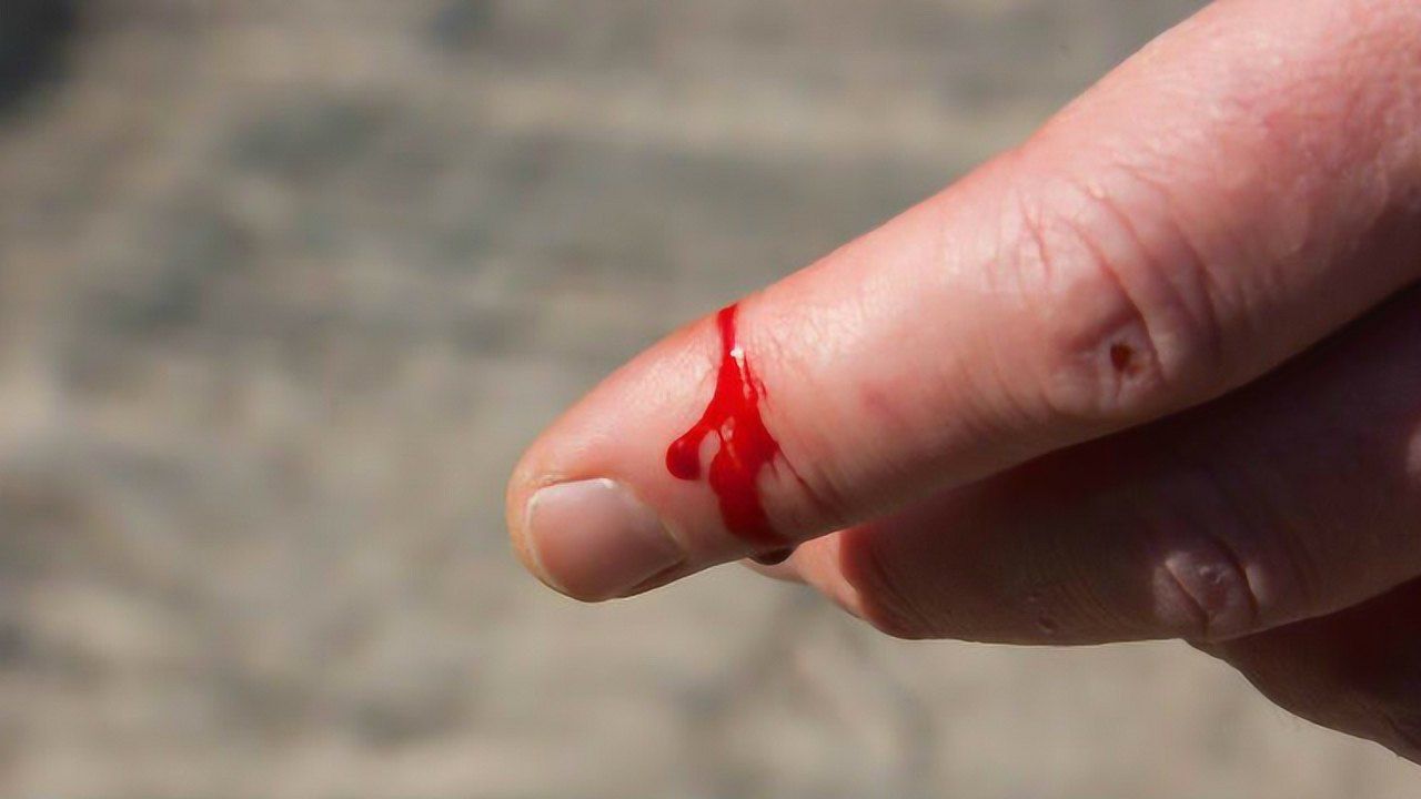 手指出血照片刀割图片