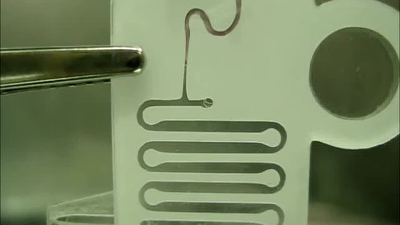 Sípon血浆分离微流控装置_腾讯视频