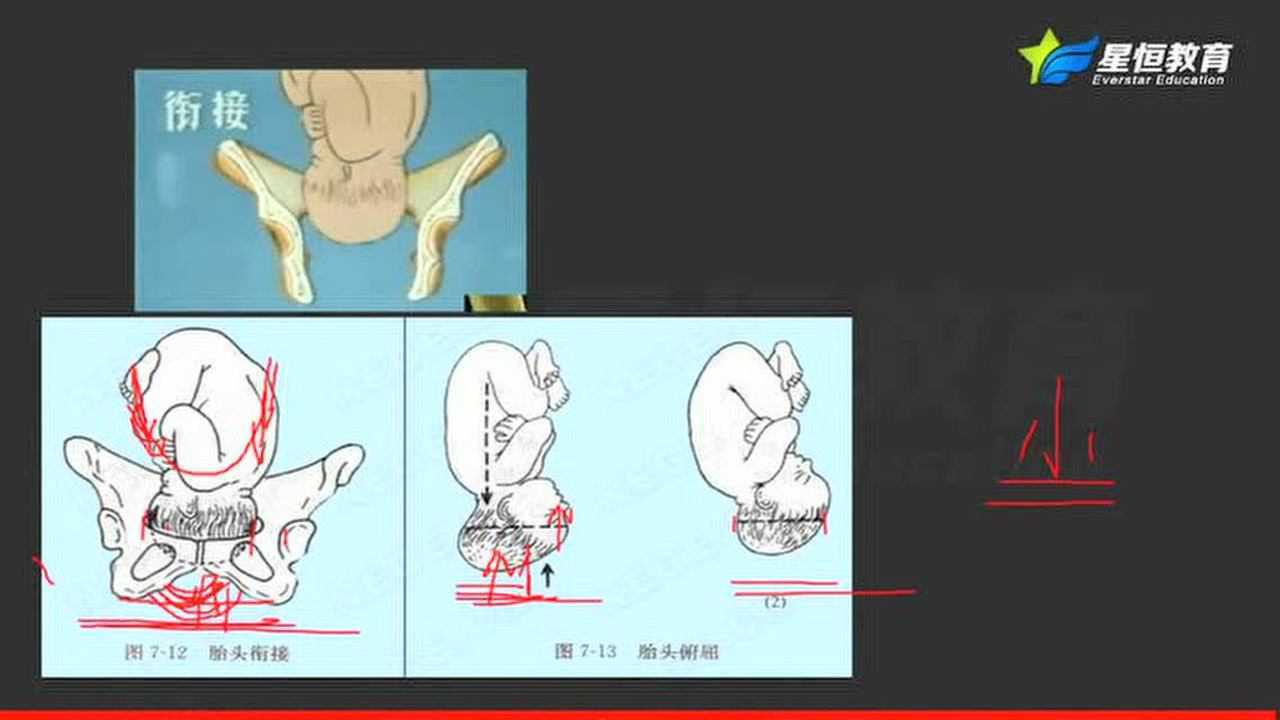 女性生殖系统视频_高清