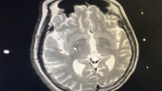 患上“偷窃病”?男子家境殷实却偷窃成瘾,不偷心里就难受