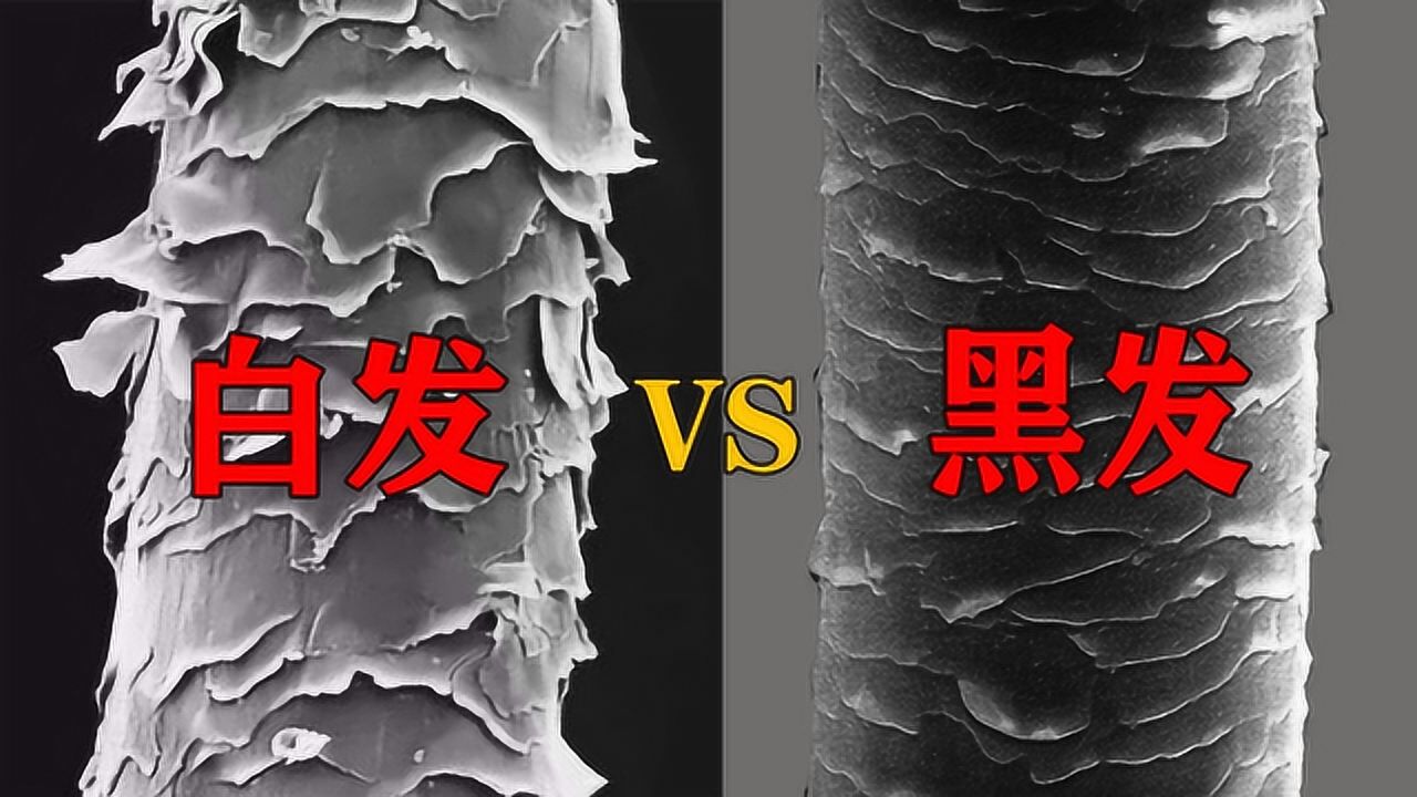 黑头发vs白头发显微镜下放大500倍后表面结构像鳞片