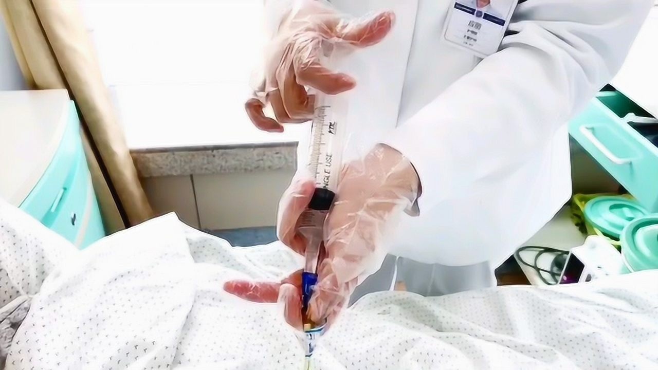 重力滴液器滴注营养液