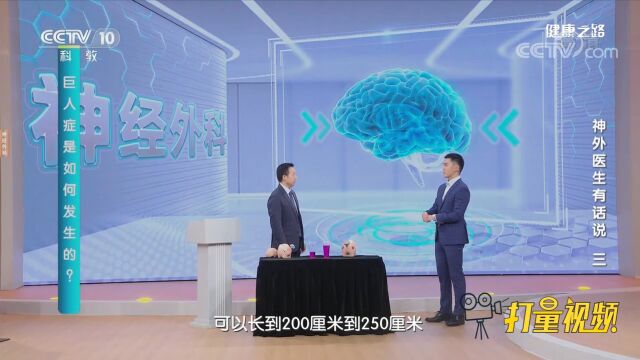 如果任其发展,巨人症可以令孩子最高长到两米到两米五