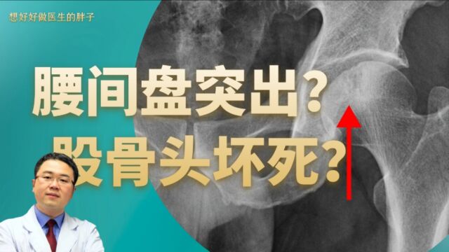 病例分析:腰椎间盘脱出患者,不能活动!医生为何建议检查髋关节