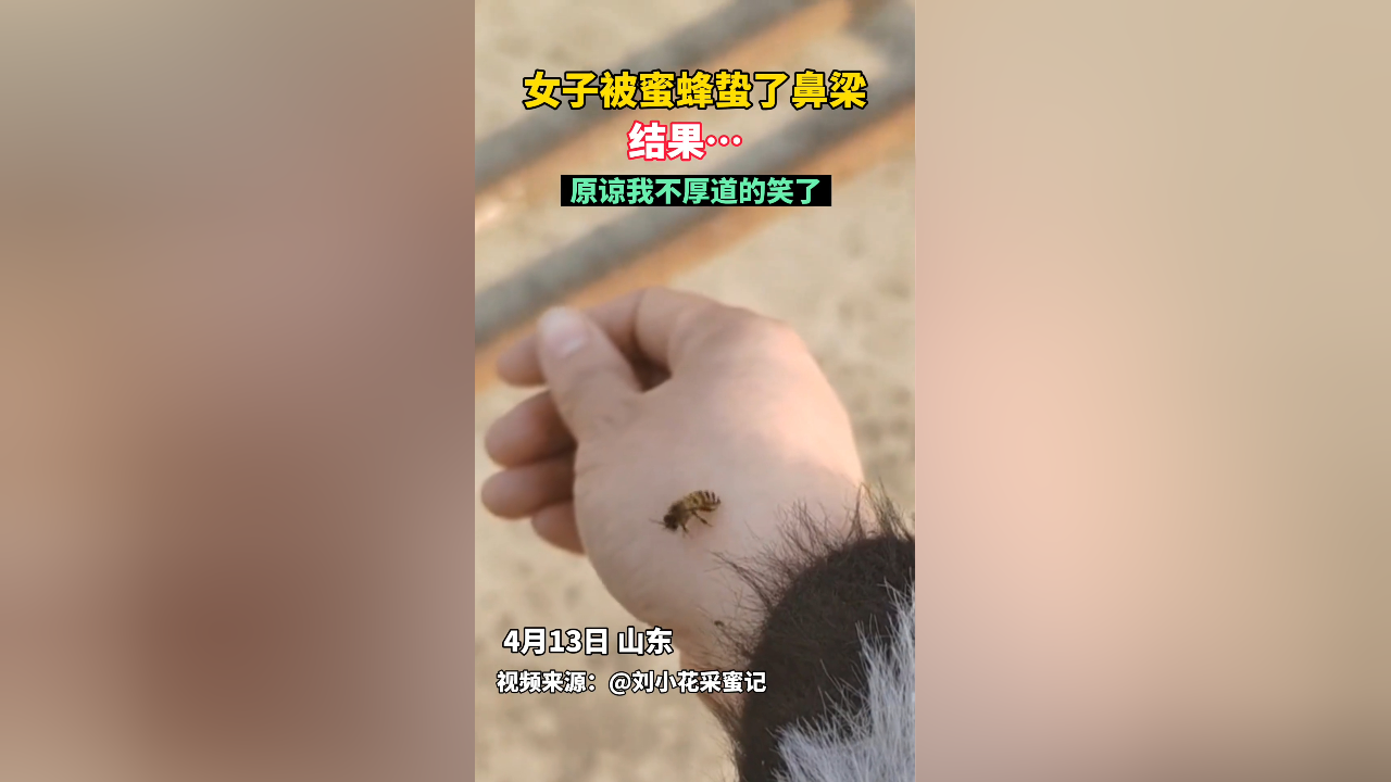 女子被蜜蜂蛰了鼻梁 结果