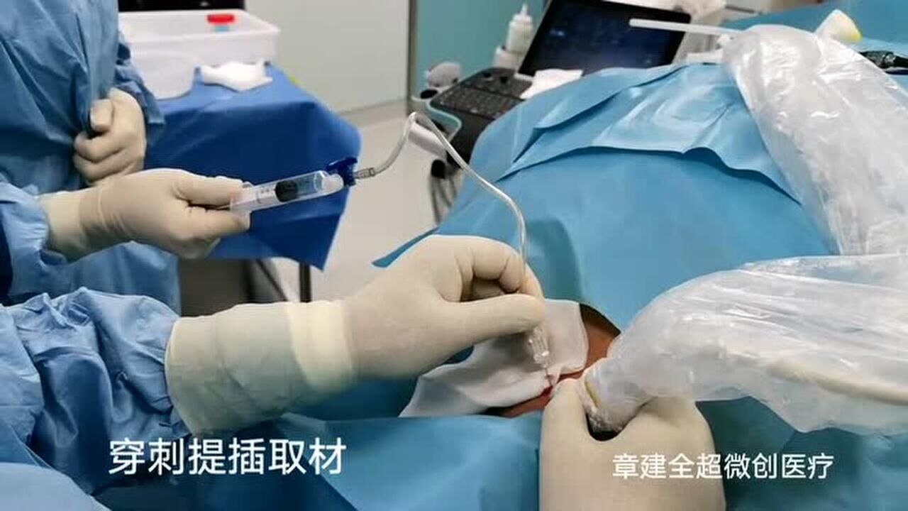 _高清1080P在线观看平台_腾讯视频