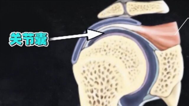 肩痛原理大揭秘!两种肩痛的形成与病因,你了解了吗?