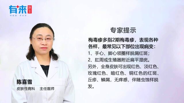 梅毒疹一般长在哪里这个地方要留意!健康知多少