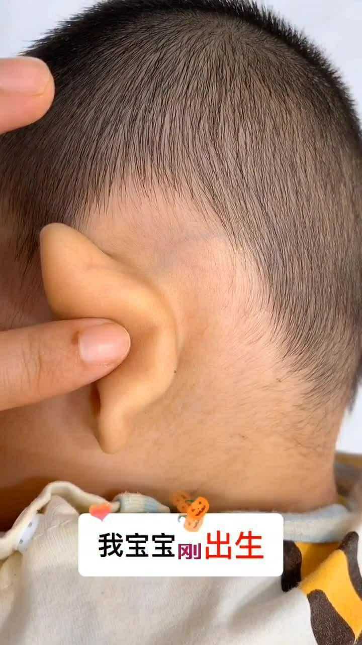 新生儿耳朵紧贴头壁如何护理,你学会了吗?