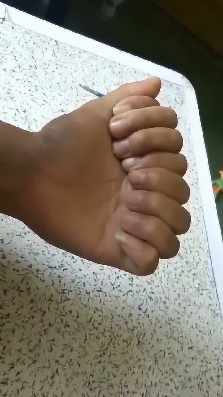 创世界吉尼斯纪录的一支手你见过这么多手指的手吗