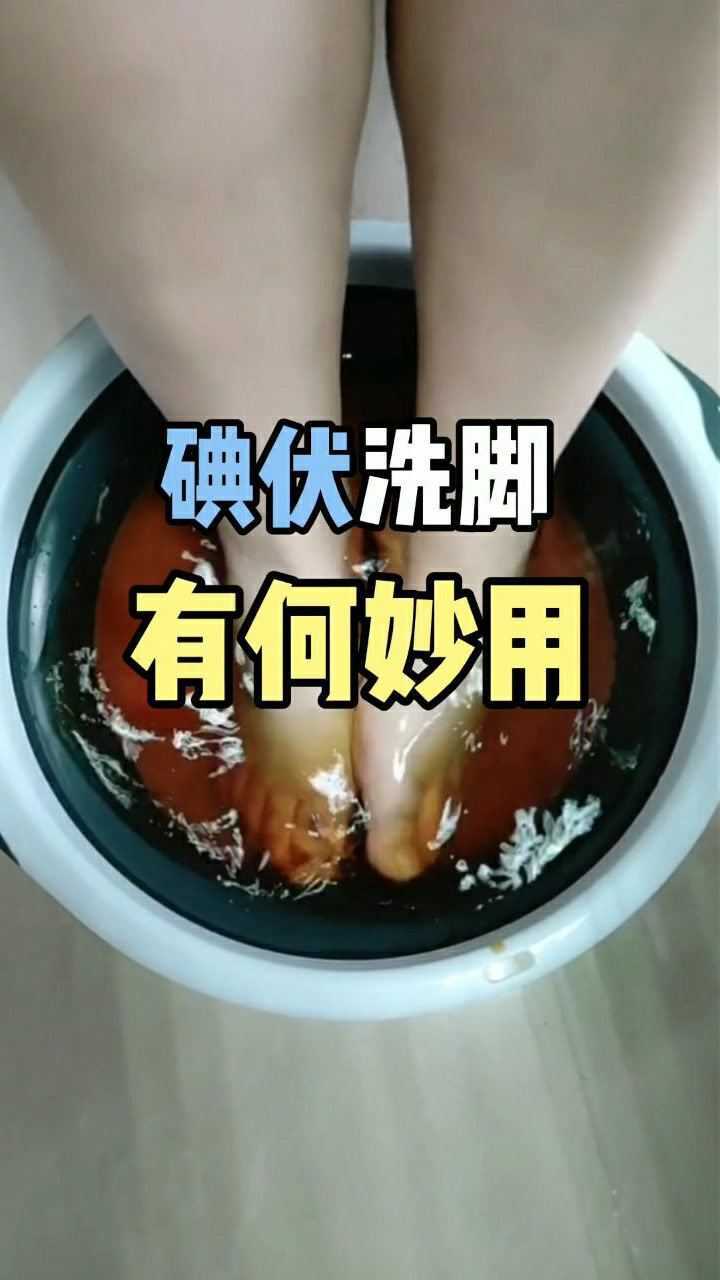 碘伏洗脚有何妙用