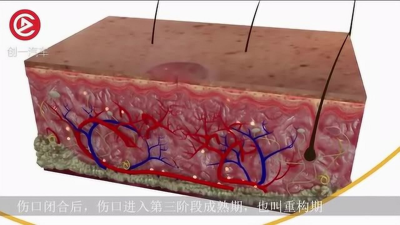 动画演示伤口愈合全过程放大一百倍过程太神奇了