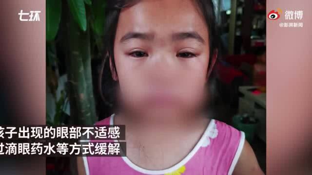 杭州一小学紫外线灯灼伤学生眼睛,校方:电工操作失误