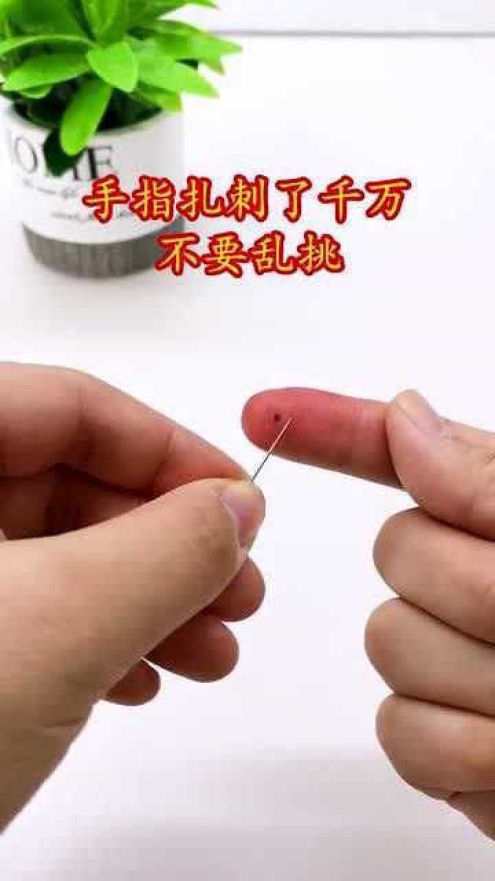 手指不小心扎刺了,千万不要用针挑,容易发炎越挑越严重,教你一招轻松