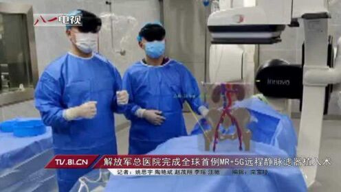 解放军总医院完成全球首例MR+5G远程静脉滤器植入术
