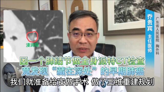 因一个肺结节做全身派特CT检查,竟发现“藏在深处”的早期肺癌