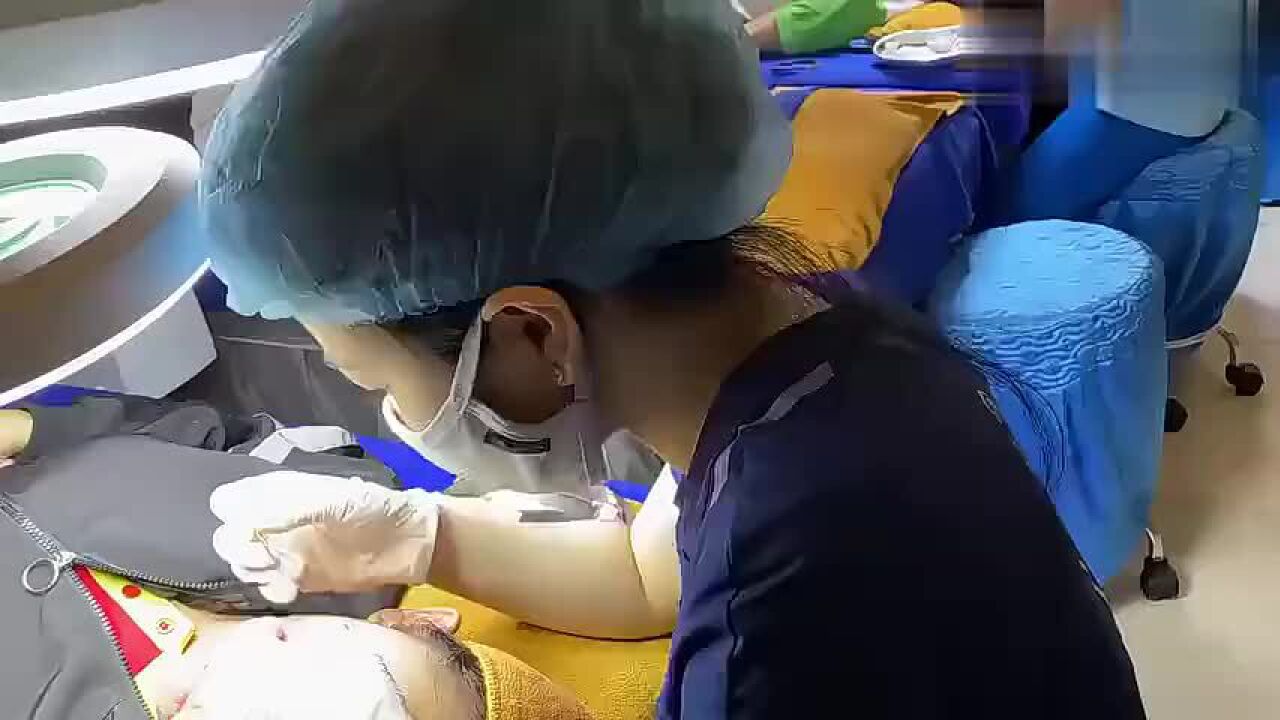 皇冠姑娘挤痘痘皮肤深处的黑头痤疮