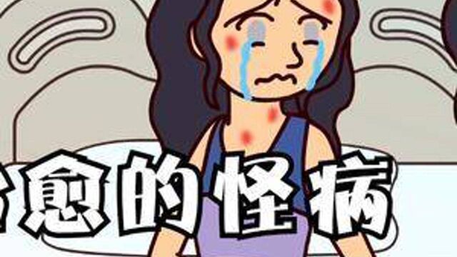 身患怪病的少女竟然对水过敏?上天给我无尽折磨,我依然面带微笑