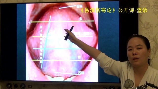 中医望舌诊舌下络脉脏腑分区易演伤寒论公开课1