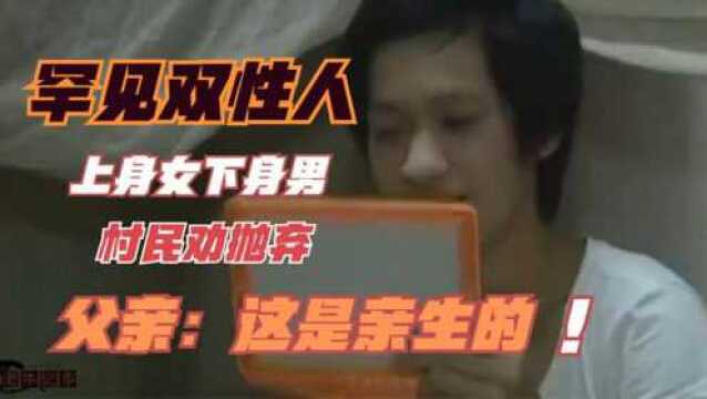 罕见双性人,上半身女性下半身男性,被劝丢弃,父亲:这是亲生的