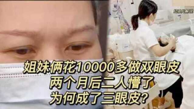 纪实:姐妹俩花10000多做双眼皮,两个月后懵了,为何成了三眼皮