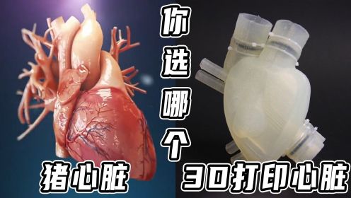 猪心脏移植患者去世，为什么不选择3D心脏