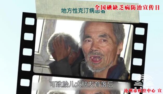 每天一点“碘”知识|碘缺乏病有什么危害?如何预防?