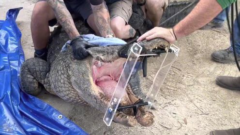 鳄鱼生病该如何救助，从其嘴里取出多颗牙齿，救援全程提心吊胆！