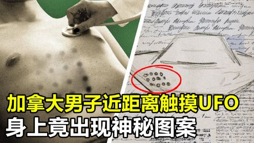 加拿大男子曾近距离触摸UFO，身上出现神秘图案，究竟怎么回事？