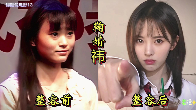 18位女星整容前后对比鞠婧祎堪称整容模板郑裕玲面目全非