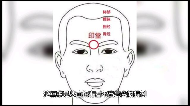 为什么有的人病势沉重,反而会好,有的人没有病,确会病亡