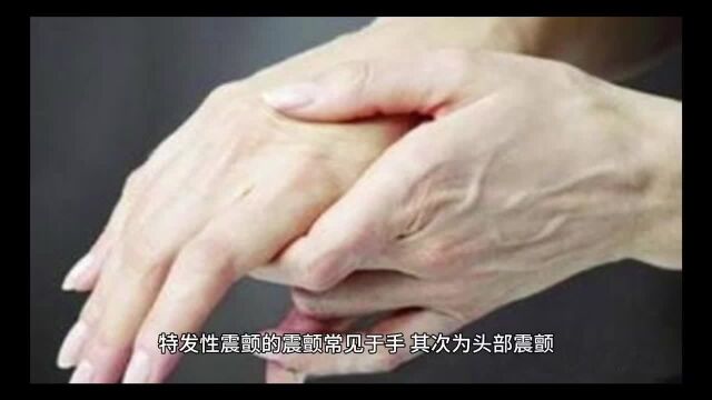 特发性震颤如何治疗?一方止“颤”,你知道吗?