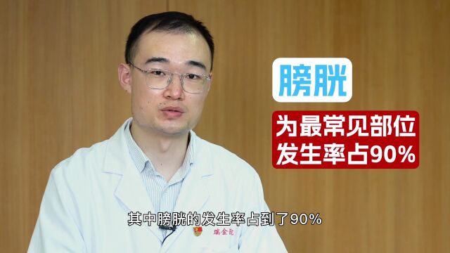 什么是尿路皮上癌 上海交通大学医学院附属瑞金医院泌尿外科黄海医生在线科普