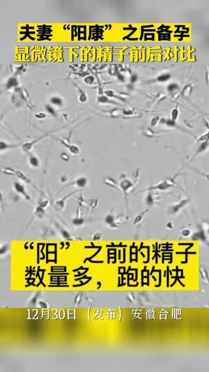 夫妻"阳康"后备孕,显微镜下精子前后对比.