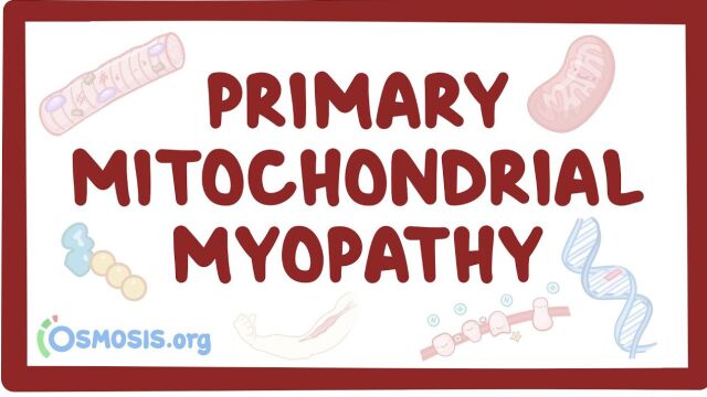 原发性线粒体肌病  原因、症状、诊断、治疗、病理