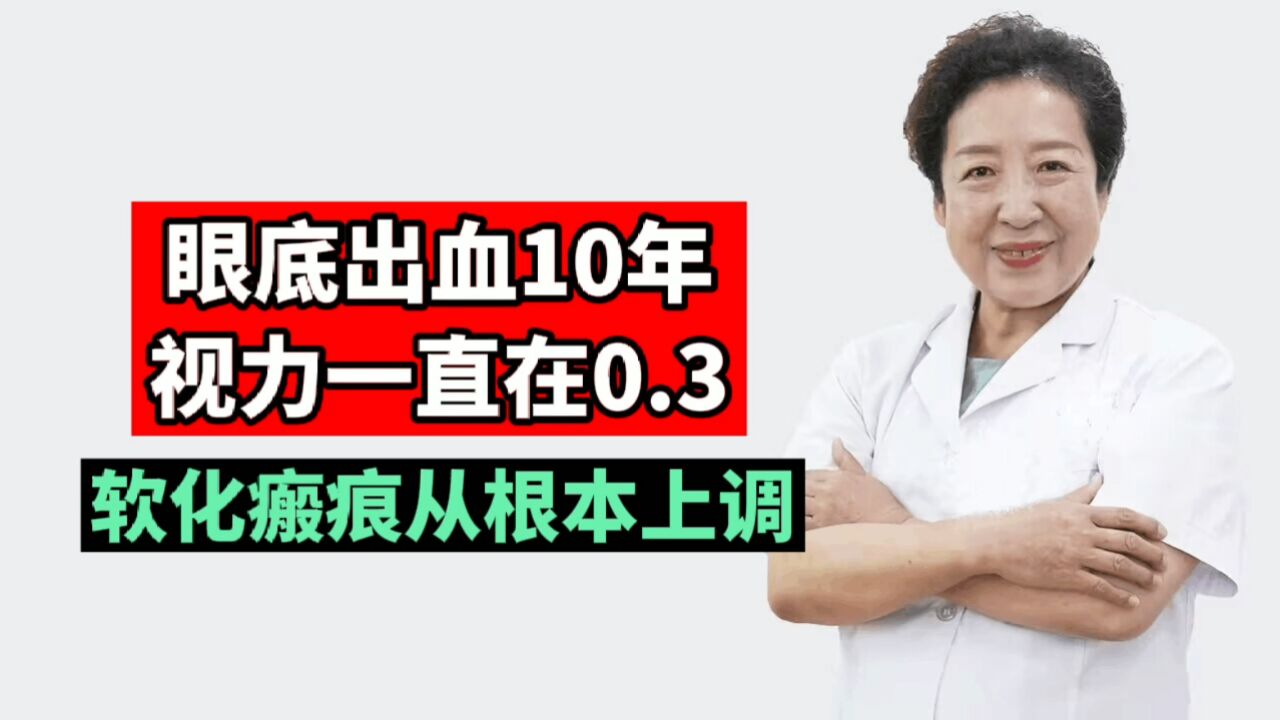 孙伟医生:眼底出血10年,视力一直在0.3,软化瘢痕从根本上调!